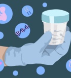 קולונוסקופיה - תמונת המחשה